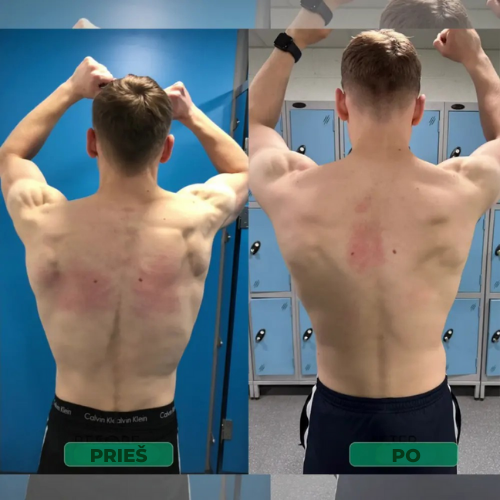 Laikysenos Korektorius – Stovėk tiesiai. Palengvink nugarą. Pajusk skirtumą jau nuo pirmos dienos.